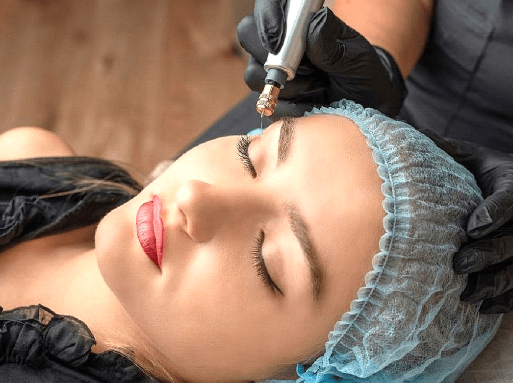 woman getting fibroblast skin therapy