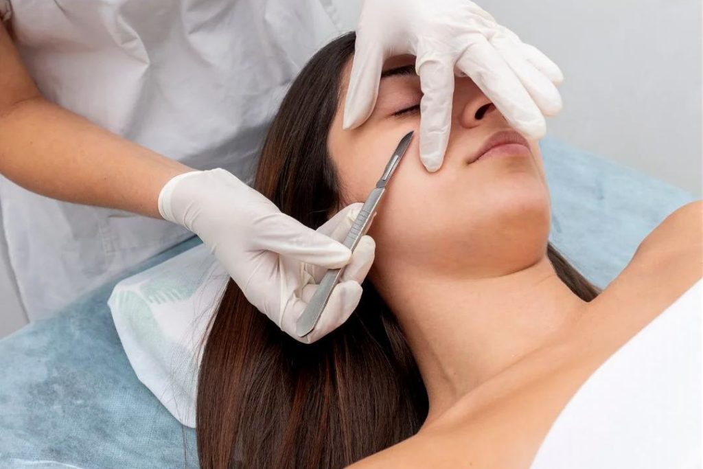 Dermaplaning Sarasota